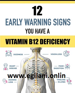 Vitamin B12 Deficiency