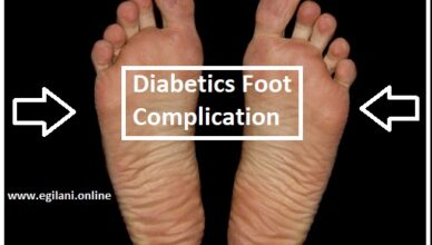 Diabetics feet care