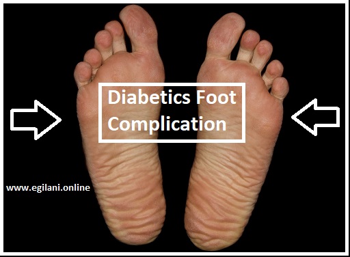 Diabetics feet care
